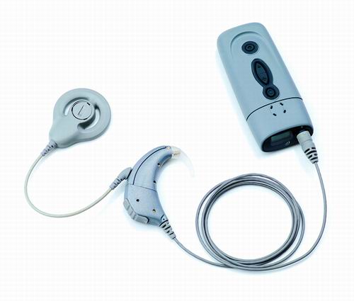 人工 耳蜗 堪比航天技术-医药卫生网