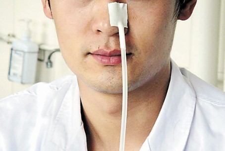 蘑菇头 更好地固定鼻饲管-医药卫生网