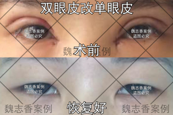 202007091154417986.png