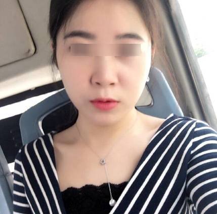 十年面瘫想到过轻生,如今一代宗师牵正方彻底